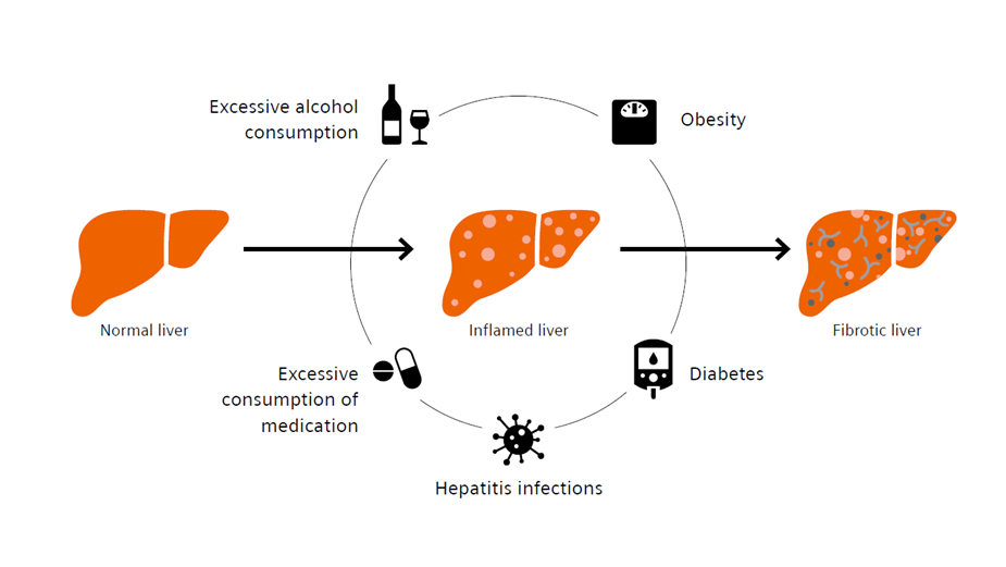 Can AI Predict And Prevent Diseases?